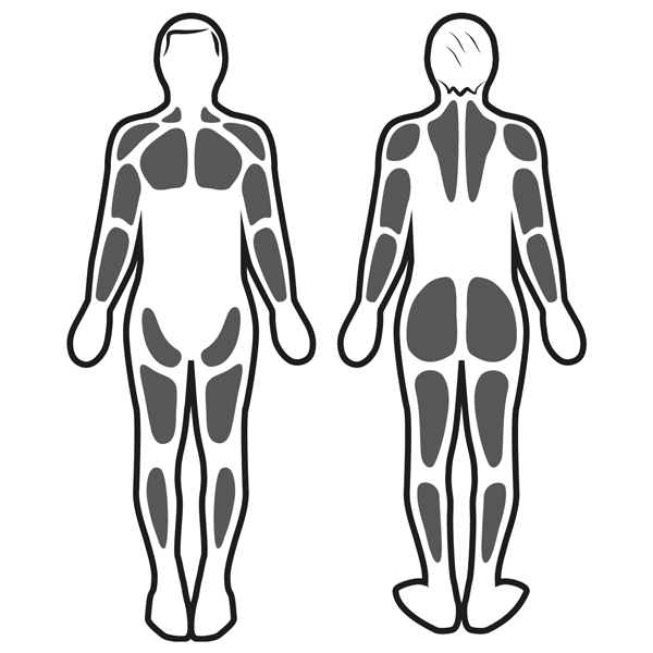 Stimulation musculaire