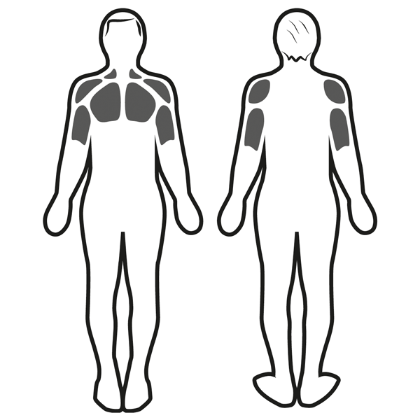 Stimulation musculaire