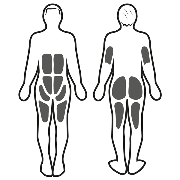 Stimulation musculaire