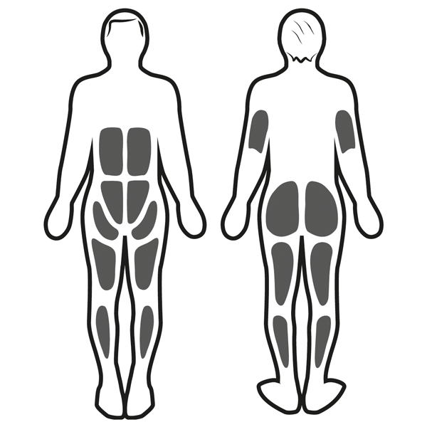 Stimulation musculaire