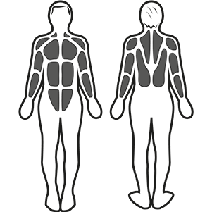 Stimulation musculaire