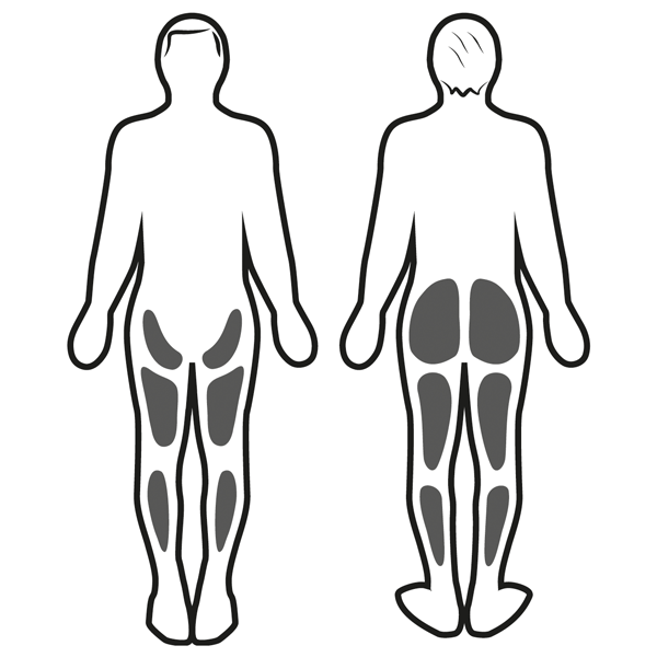 Stimulation musculaire